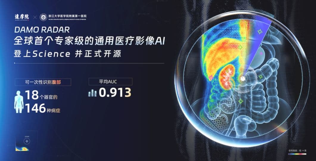 알리바바, 150종 복부질환 진단 AI 오픈소스 공개